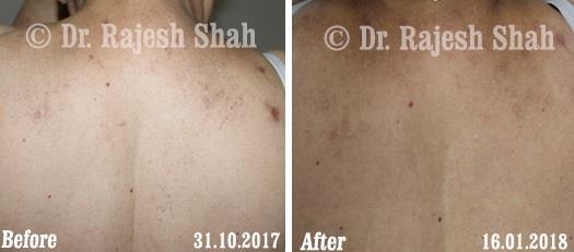 lifeforce homeopathy case-photos